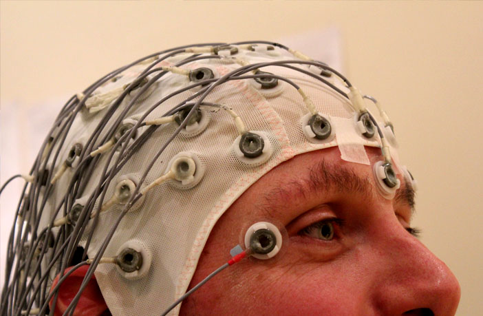 Study finds EEG brain tests can help patients overcome depression